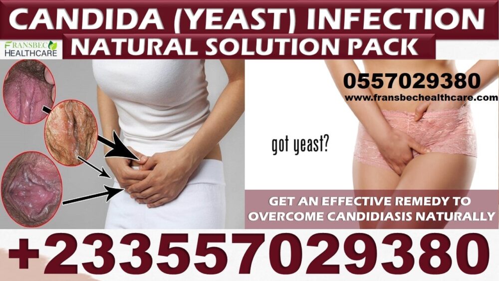 Best Candida Vaginal Infection Natural Solution in Ghana