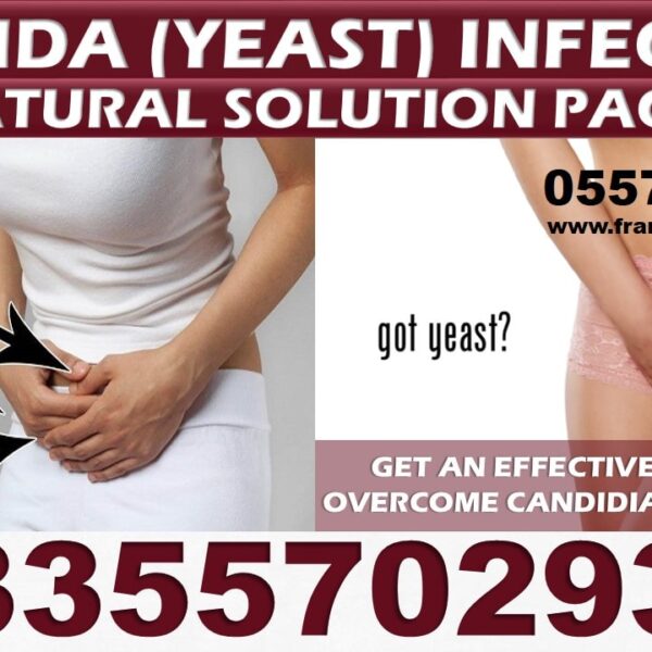 Best Candida Vaginal Infection Natural Solution in Ghana