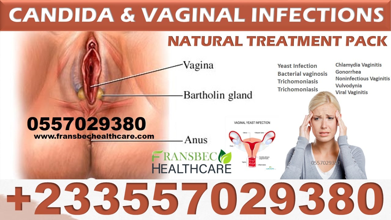 Best Candida Vaginal Infection Natural Supplements in Ghana