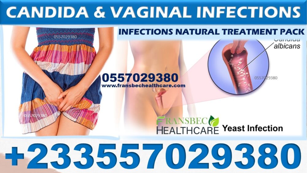 Best Candida Vaginal Infection Natural Products in Ghana