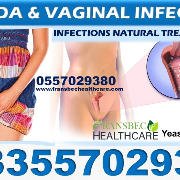 Best Candida Vaginal Infection Natural Treatment in Ghana