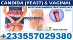 Best Candida Vaginal Infection Natural Treatment in Ghana