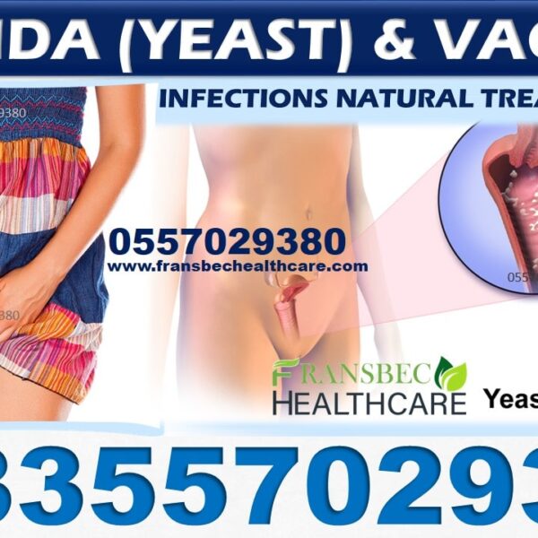 Best Candida Vaginal Infection Natural Treatment in Ghana
