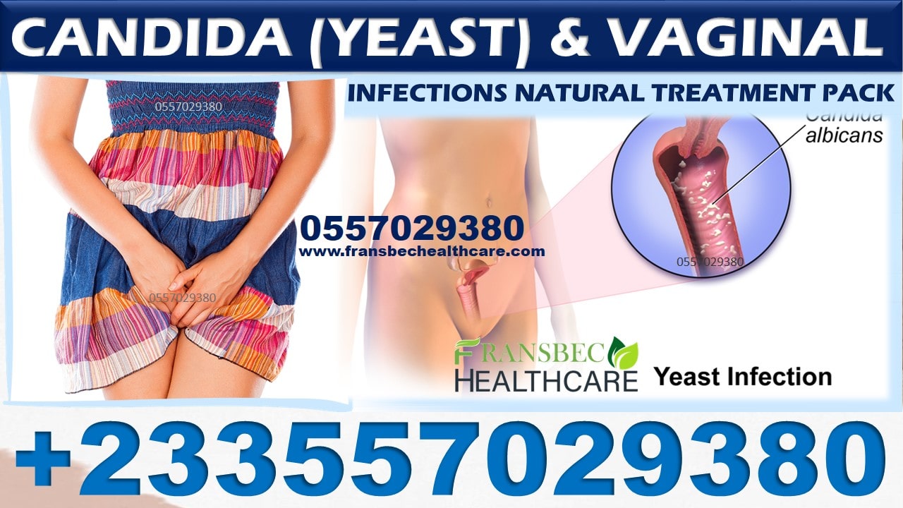 Best Candida Vaginal Infection Natural Treatment in Ghana