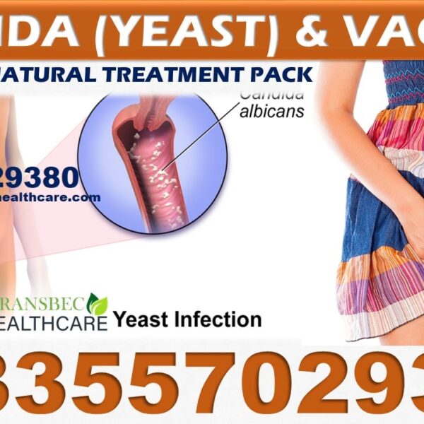 Best Candida Vaginal Infection Natural Treatment in Ghana