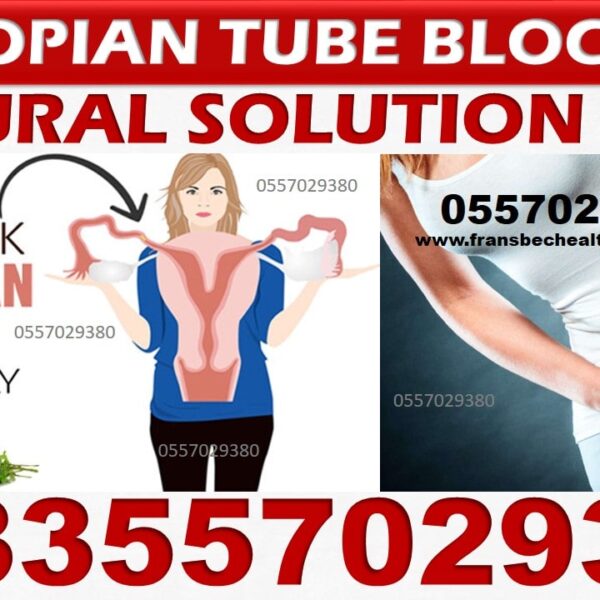 Best Blocked Fallopian Tubes Natural Treatment in Ghana