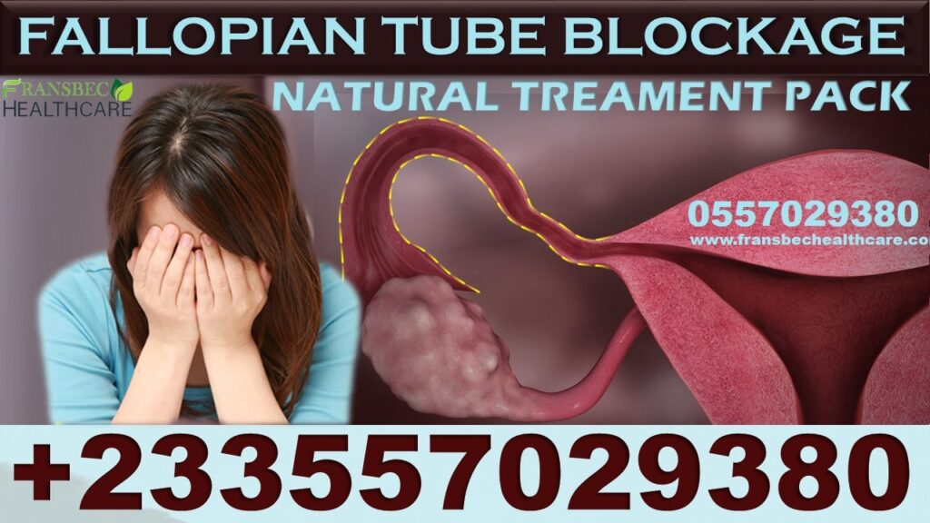 Blocked Fallopian Tubes Natural Pack