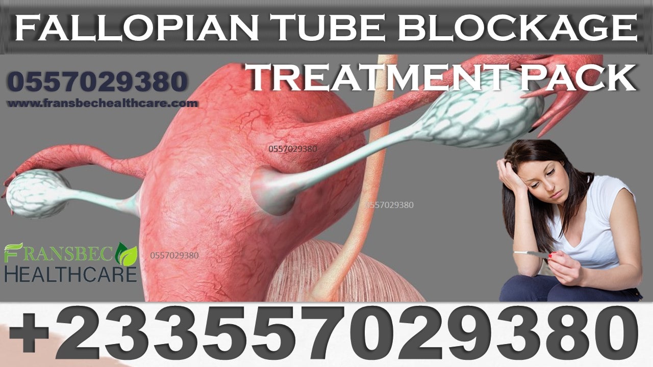 Best Blocked Fallopian Tubes Natural Treatment in Ghana