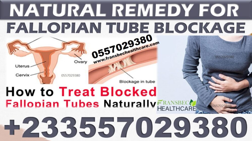 Best Blocked Fallopian Tubes Natural Solution in Ghana