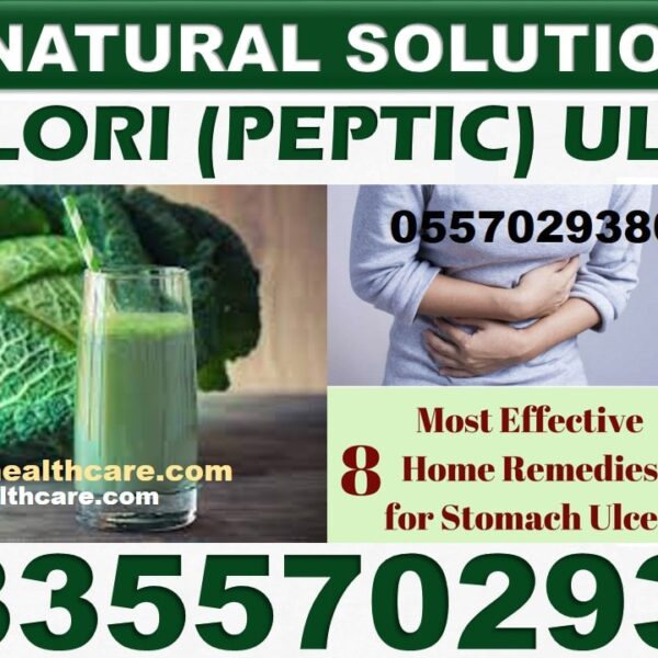 Best Gastritis Natural Supplements in Ghana