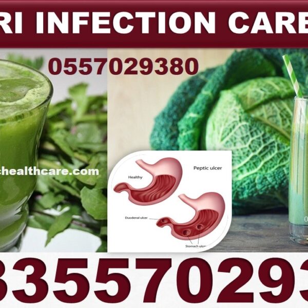 Best H Pylori Bacteria Natural Products in Ghana