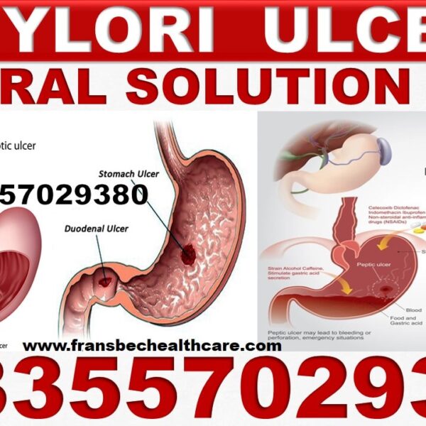Best H Pylori Bacteria Natural Supplements in Ghana