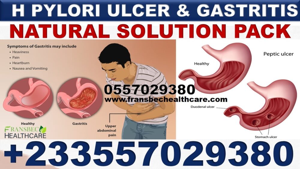 Forever Living Supplements to Get Rid of Stomach Ulcer