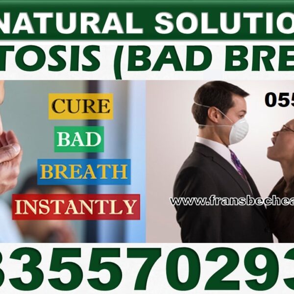 Best Bad Breath Natural Medicine in Ghana
