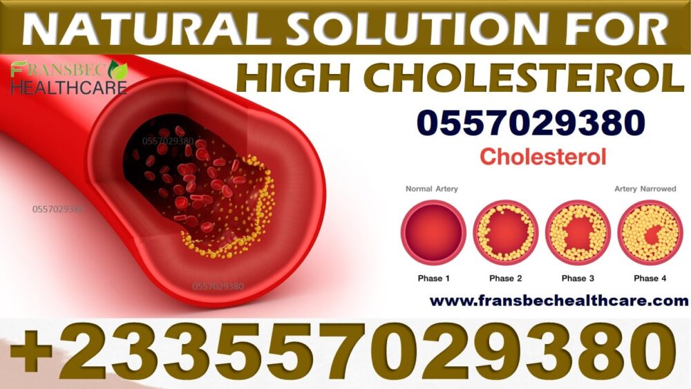 Best High Blood Cholesterol Natural Supplements in Ghana