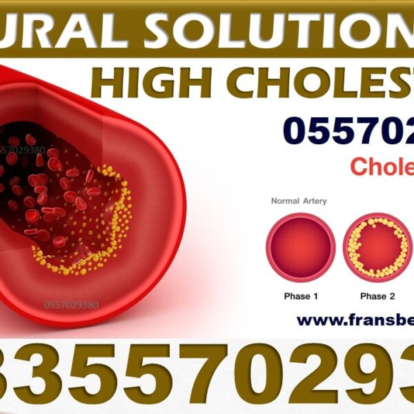 Best High Blood Cholesterol Natural Supplements in Ghana
