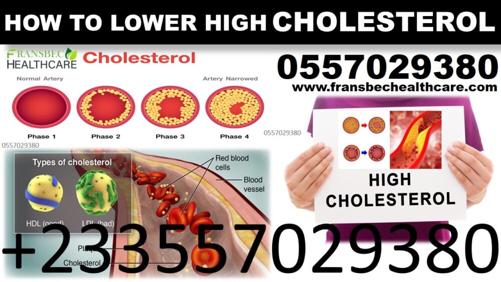 Best High Blood Cholesterol Natural Supplements in Ghana