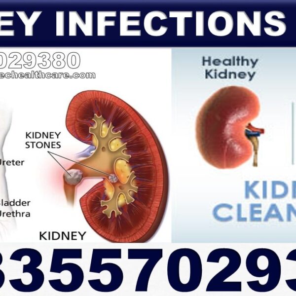 Herbal Supplements for H Pylori Bacteria in Ghana