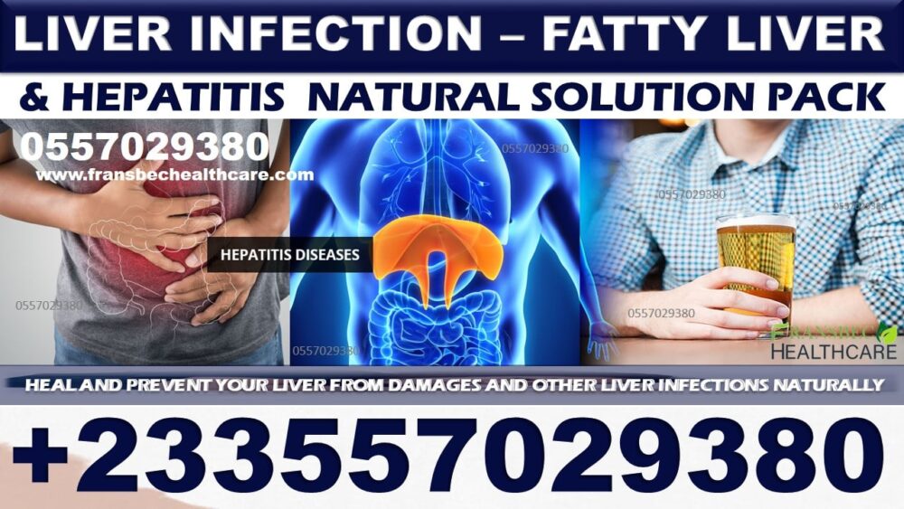 Natural Remedies for Liver Infection in Ghana