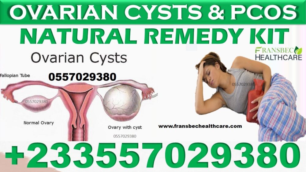 Best Ovarian Cyst Natural Supplements in Ghana