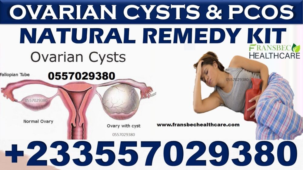 Best Ovarian Cyst Natural Treatment in Ghana