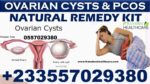 Best Ovarian Cyst Natural Treatment in Ghana