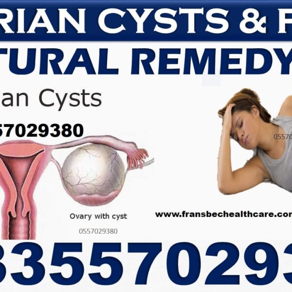 Best Ovarian Cyst Natural Treatment in Ghana