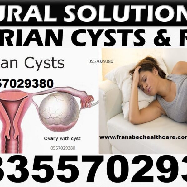 Best Ovarian Cyst Natural Treatment in Ghana