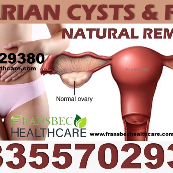 Best Ovarian Cyst Natural Products in Ghana