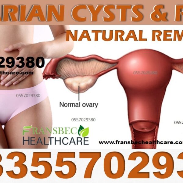 Best Ovarian Cyst Natural Treatment in Ghana