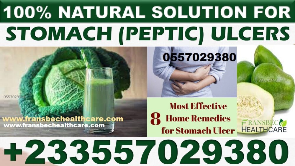 Best Gastric ulcer Natural Medicine in Ghana