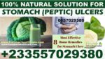 Best Gastric ulcer Natural Medicine in Ghana