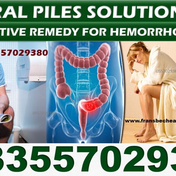 Herbal Products for Hemorrhoids in Ghana