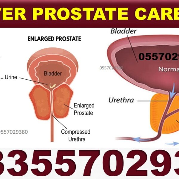 Prostate Care Natural Treatment Pack