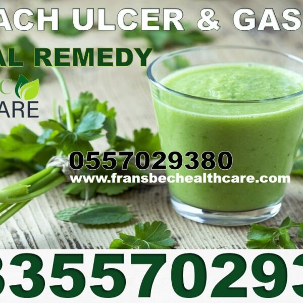 Best Gastric ulcer Natural Supplements in Ghana