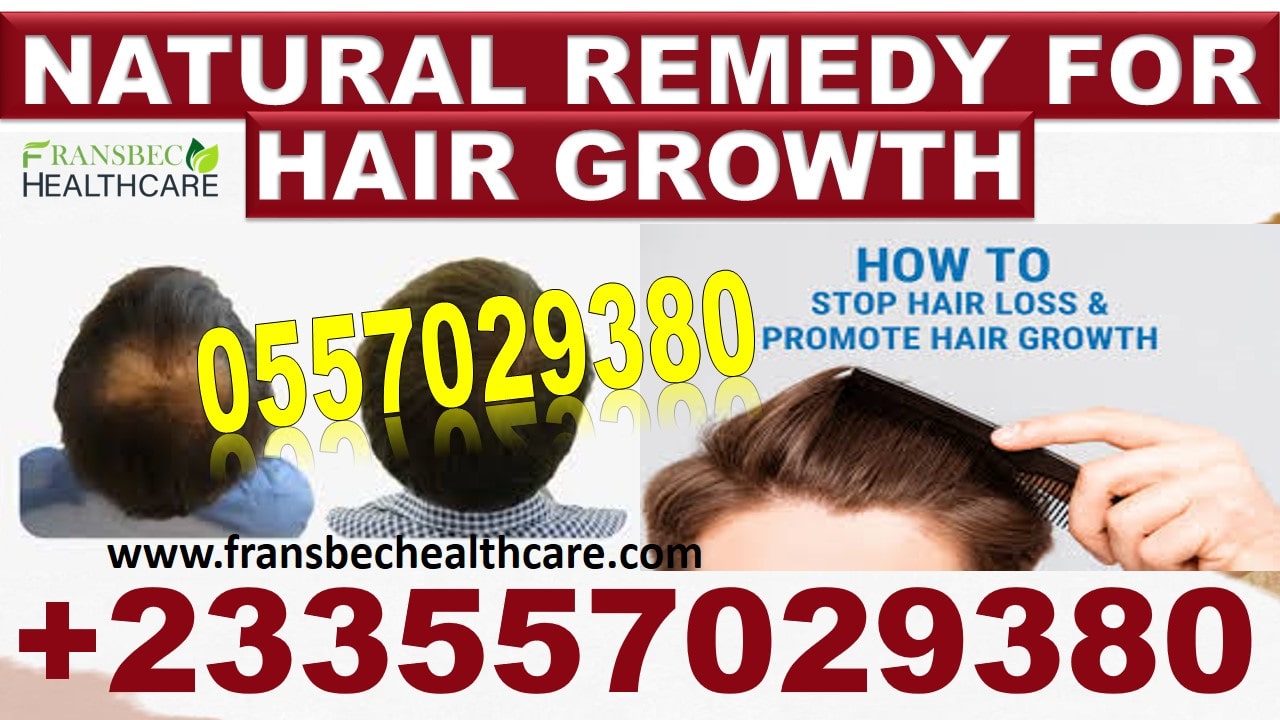 Best Hair Growth Natural Supplements in Ghana