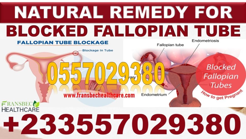 Best Blocked Fallopian Tubes Natural Supplements in Ghana
