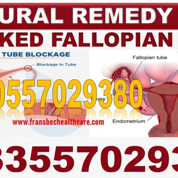 Herbal Supplements for Blocked Fallopian Tubes in Ghana