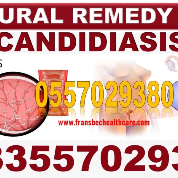 Home Remedies for Candida Vaginal Infection in Ghana