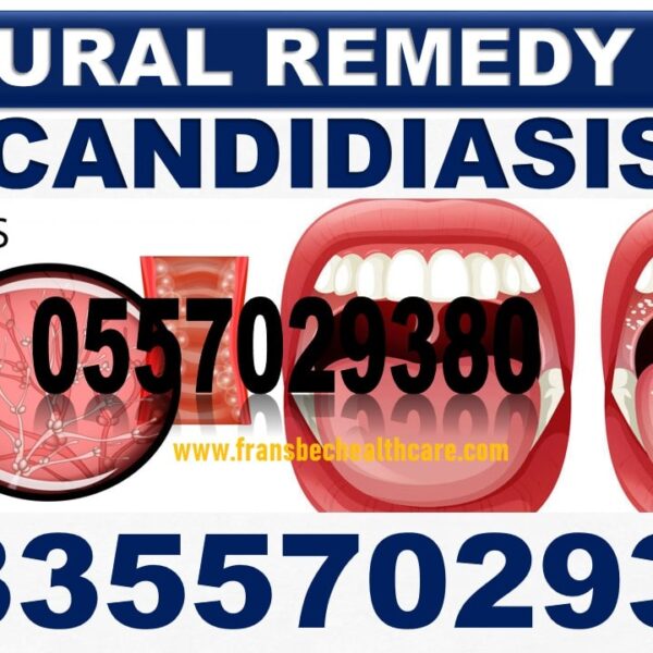 Herbal Remedies for Candida Vaginal Infection in Ghana