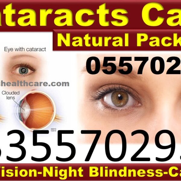 Best Cataract Natural Medicine in Ghana
