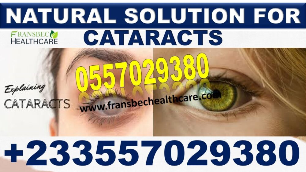 Best Cataract Natural Solution in Ghana