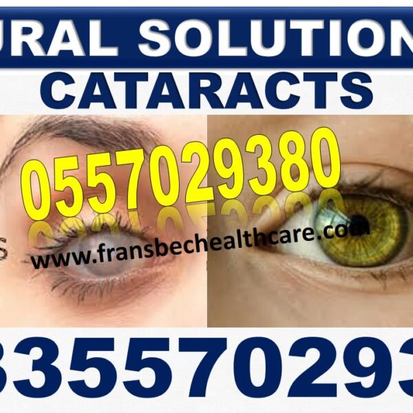 Best Cataract Natural Solution in Ghana