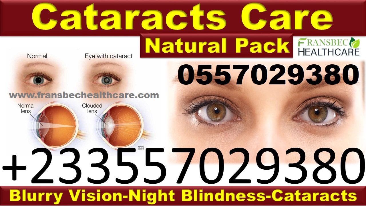 Best Solution for Cataract in Ghana