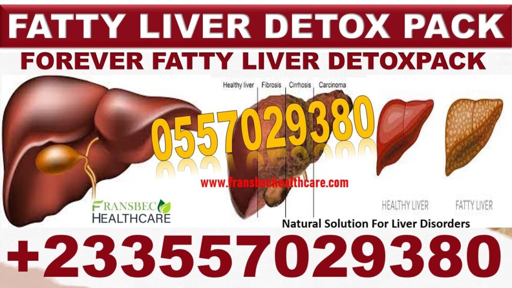 Natural Treatment for Liver Infection in Ghana