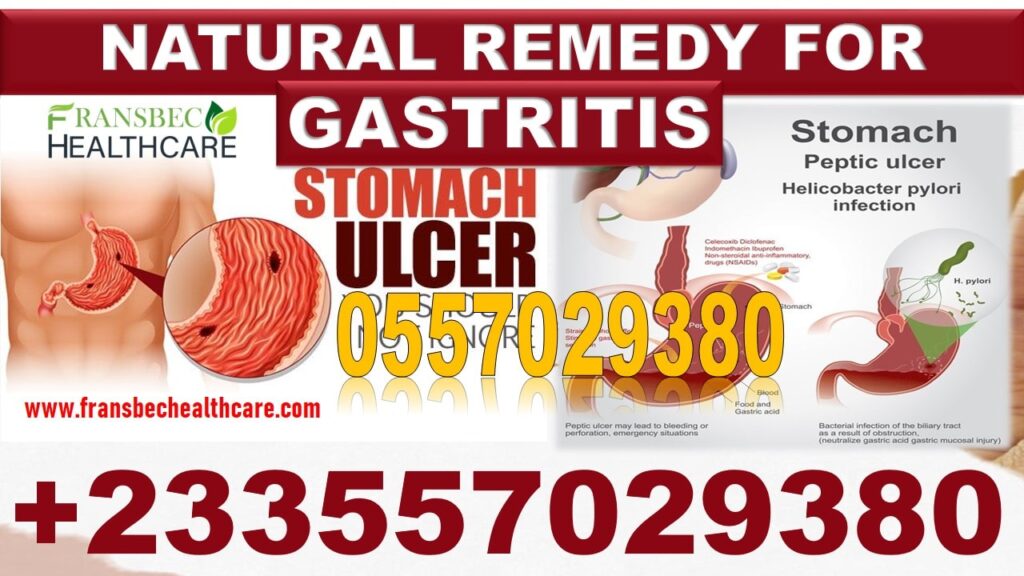 Best Gastritis Natural Remedy in Ghana - 0557029380