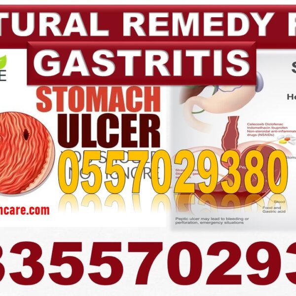 Natural Treatment for Gastritis in Ghana