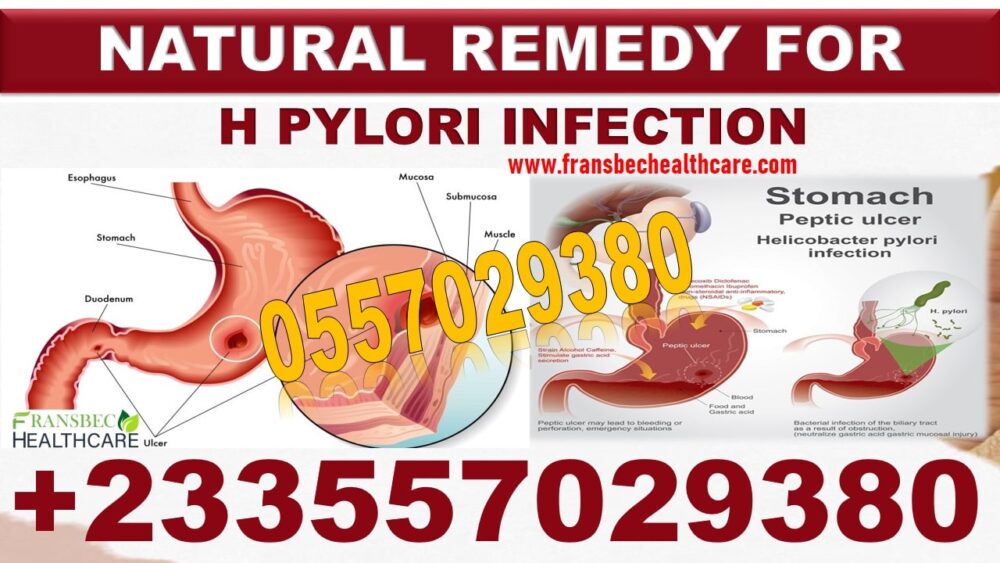 Forever Natural Products for H Pylori Bacteria