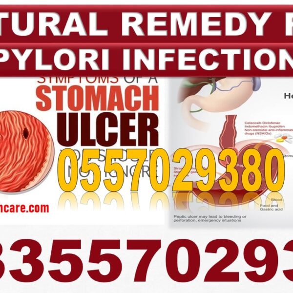 Best H Pylori Bacteria Natural Solution in Ghana