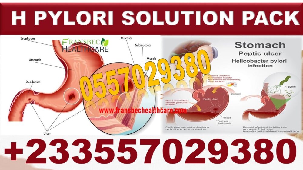 Herbal Medicine for H Pylori Ulcer in Ghana